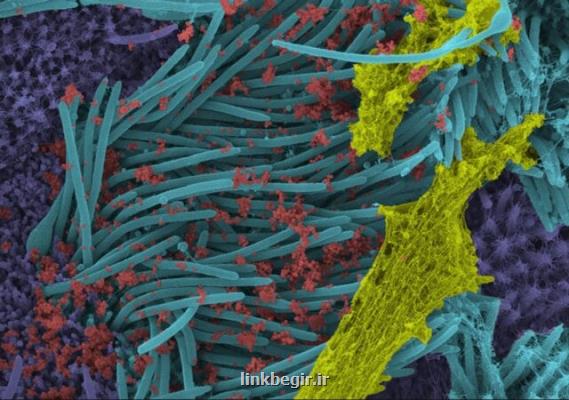 تصاویر سلول های آلوده به كروناویروس سندرم حاد تنفسی ۲ منتشر گردید
