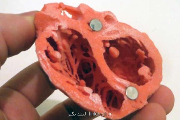 یافته های جدیدی در مورد ارتباط افسردگی با بیماری قلبی-عروقی
