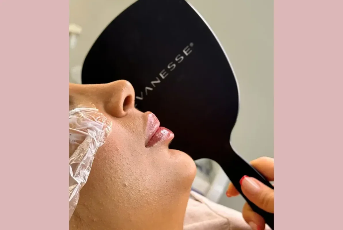 استفاده از فیلر لب چه تاثیری در زیبایی صورت دارد؟