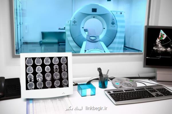 بررسی بهتر مغز بیماران اسكیزوفرنیك با روش تصویربرداری جدید